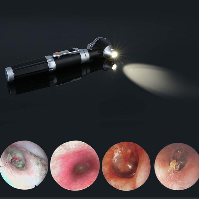 Bysameyee Mini Ear Otoscope, Bysameyee Magnification Diagnostic Ear Scope with LED Direct Illumination Light, Ear Healthy Tool for Doctors Nurses Adults Kids Baby Elder Pets Animals