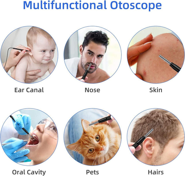 Jiusion 3.9Mm Ultra-Thin Portable USB Digital Otoscope Camera with Carrying Case, HD 720P 6 LED Visual Ear Scope with 3 Hats 2 Silicone Caps 8 Earwax Spoons for Android Windows Mac NOT for Iphone Ipad