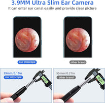 Jiusion 3.9Mm Ultra-Thin Portable USB Digital Otoscope Camera with Carrying Case, HD 720P 6 LED Visual Ear Scope with 3 Hats 2 Silicone Caps 8 Earwax Spoons for Android Windows Mac NOT for Iphone Ipad - The Gadget Collective